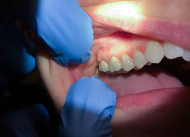Best Root Canal Emergency Dentist  in Shady Point, OK